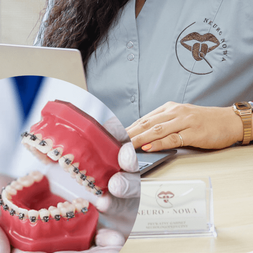 Ortodoncja jako mwtoda wspierająca logopedię